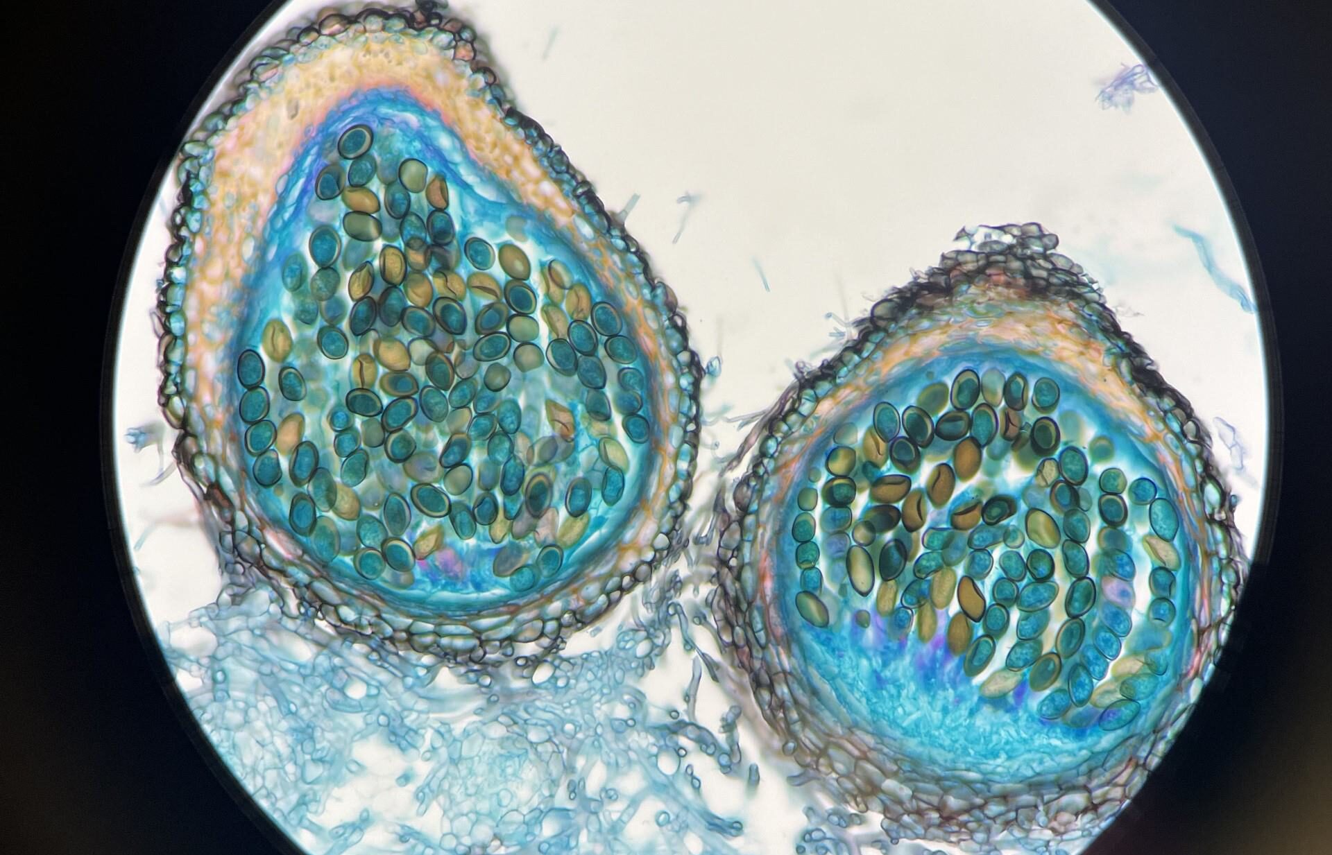 Microscopy image of a budding yeast Microscopy image of a budding yeast