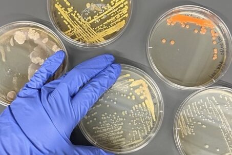 A gloved hand touches agar plates containing microbial colonies.